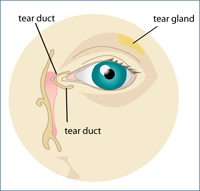 Dry Eye Syndrome Garden City